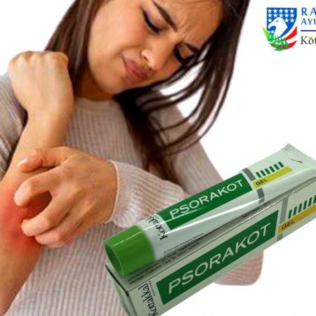 Kottakkal Psorakot- Skin Problems 50g