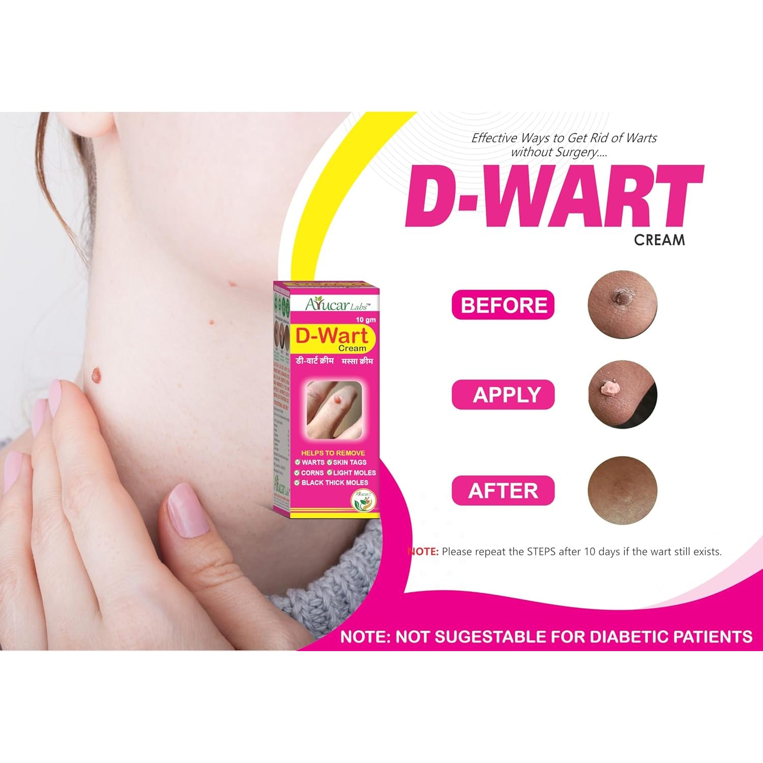 Ayurvedic D-Wart Cream | Herbal Wart & Skin Tag Remover | For Clear & Healthy Skin - 10g - Image 6